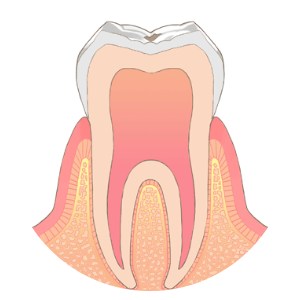 【見た目】ぱっと見は変化がなく、よく見ると白く濁った部分がある