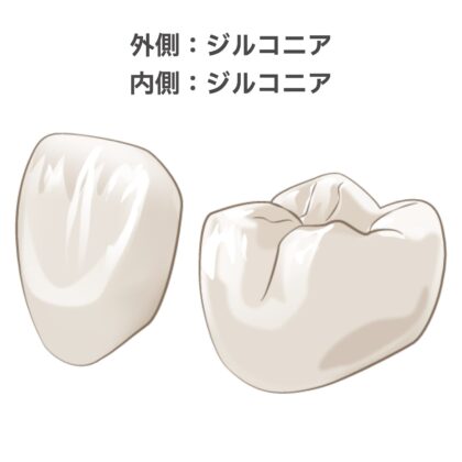 オールジルコニアクラウン