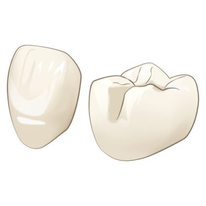 オールセラミッククラウン（e-max）