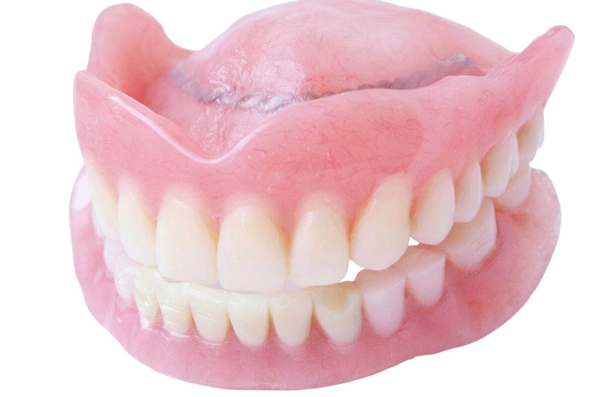 レジン床義歯